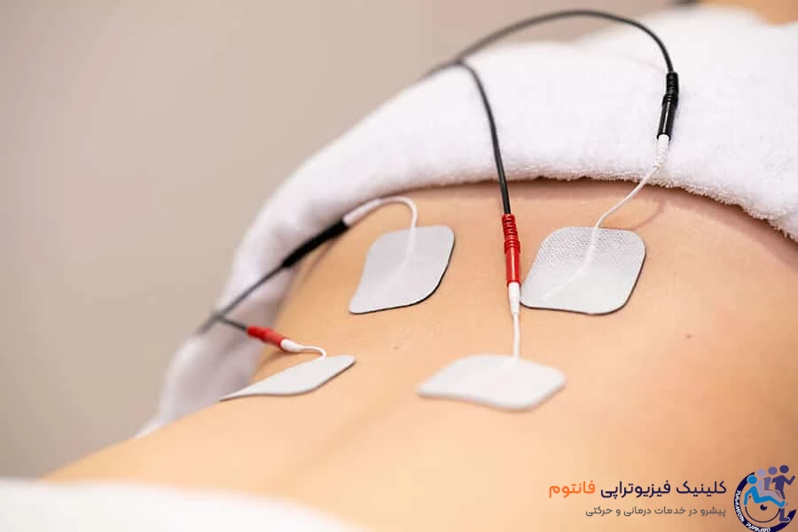 الکتروتراپی در فیزیوتراپی: فناوری در خدمت بهبودی