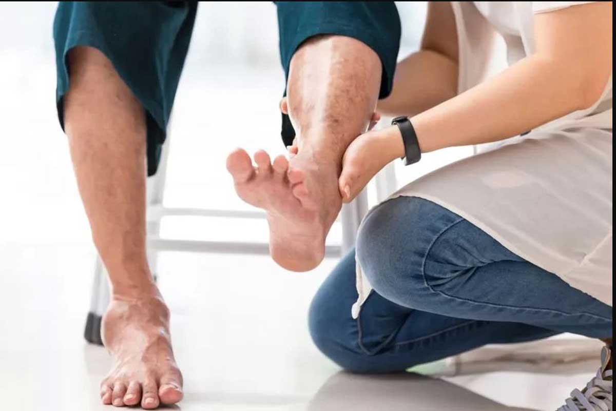 روش‌های درمانی خانگی نوروپاتی دیابتی