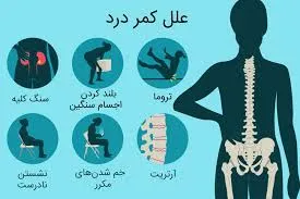 علائم کمر درد - فیزیوتراپی پونک زنجان