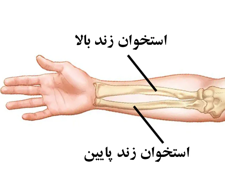 شکستگی استخوان اولنا