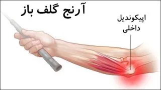 روش های درمان آرنج گلف بازان در فیزیوتراپی پونک زنجان
