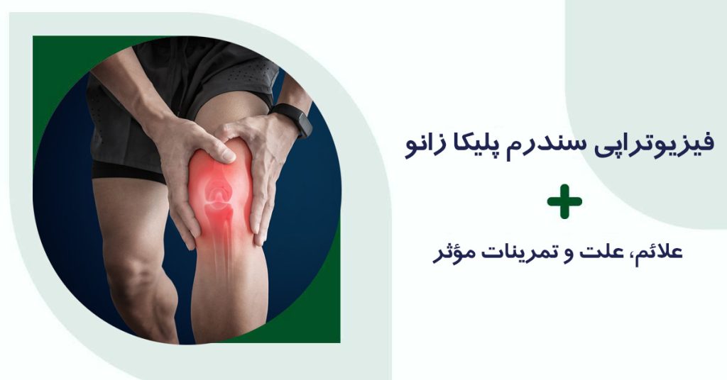 سندروم پلیکا زانو